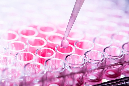 From Bovine to Human: Human Platelet Lysate in Cell Culture and Translational Research