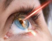 UT Southwestern ophthalmologist shares techniques for cataract surgery complications